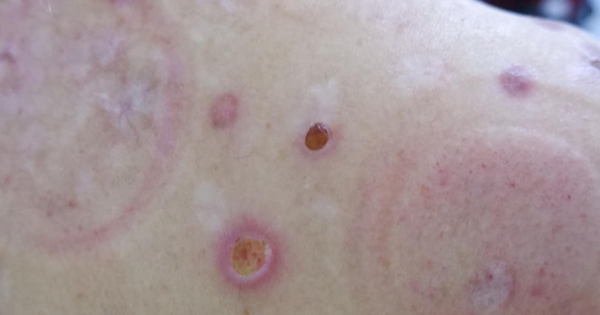 Đốt ngải, đốt hương: Nguy hiểm đến bất ngờ cho sức khỏe