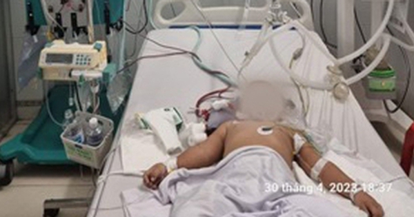 Cách hội chẩn từ xa cứu sống bệnh nhi nguy kịch dịch tay chân miệng