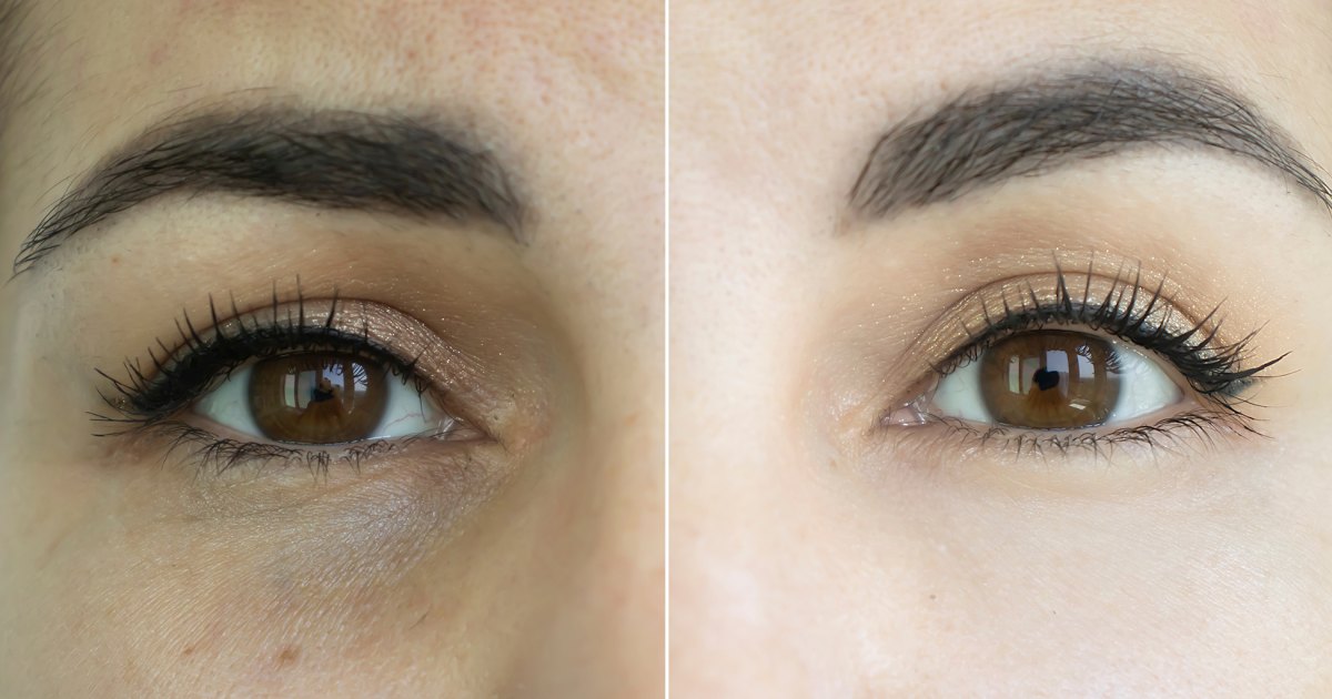 Revitalize Your Eyes with These 52% Discounted Anti-Aging Masks
