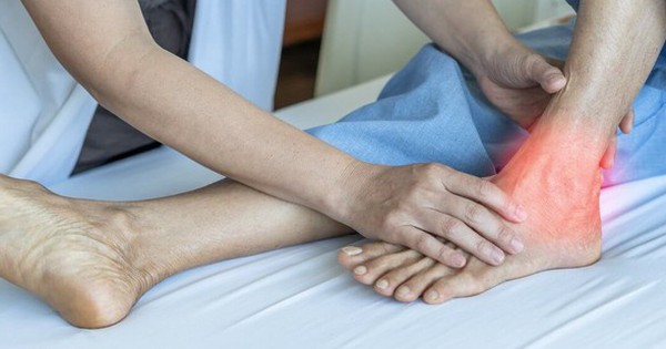 Cú shock kinh hoàng: Những điều bất ngờ theo sau bệnh gout, viêm ruột