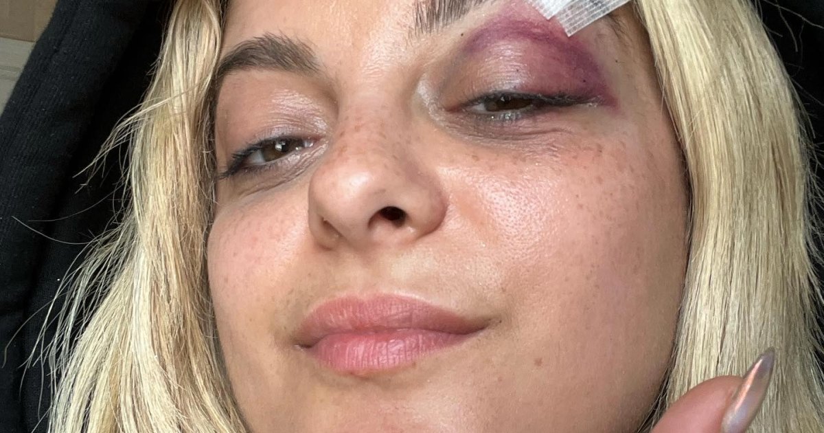 Shocking Images: Bebe Rexha Braves Fan Attack with Grace