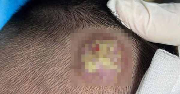 Ngủ chung với thú cưng có thể gây bệnh da lạ?