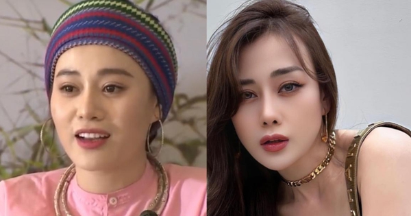 Phương Oanh: Biến đổi nhan sắc sau phẫu thuật thẩm mỹ - Bạn sẽ bất ngờ!