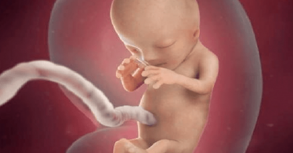 Mẹ bầu cần nhận biết những dấu hiệu nghi ngờ nước ối ít: Bí quyết quan trọng mà bạn cần biết!