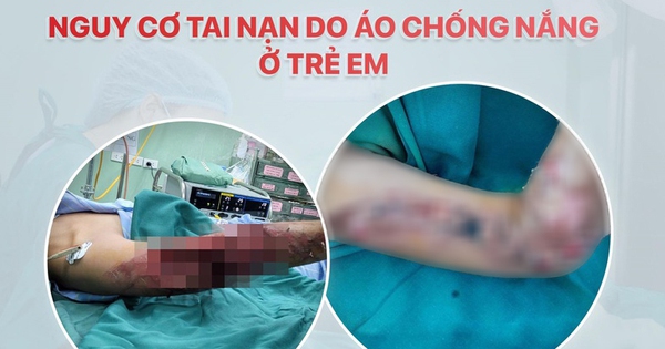 Bí mật nguy cơ tai nạn chưa từng tiết lộ về áo chống nắng