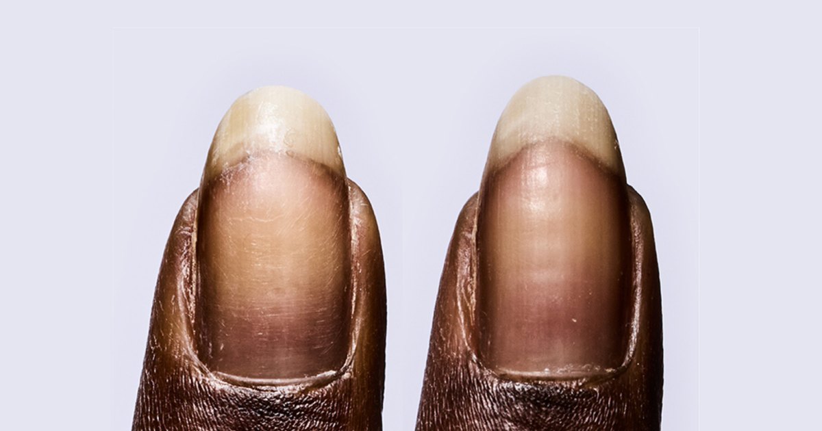 Revive and Transform Your Nails in Just 6 Days With This Ultimate Strengthening Treatment