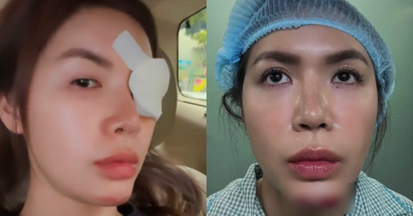 Minh Tú chia sẻ về sức khỏe kể từ vụ việc phẫu thuật, thu hút sự chú ý