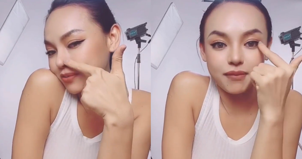 Nhìn ngay hình ảnh Á hậu Mai Ngô sau phẫu thuật thẩm mỹ, nhan sắc quá đổi khác!