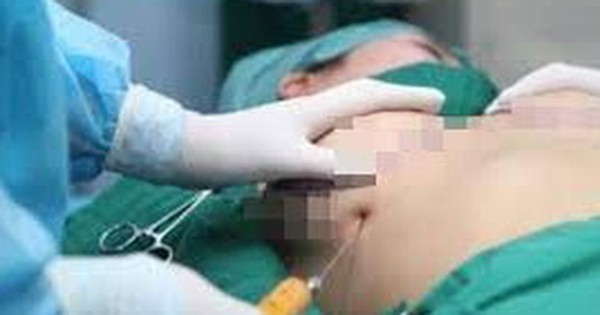 Tạm giữ người phụ nữ thiếu hiểu biết khi thực hiện phẫu thuật nâng ngực chui gây tử vong