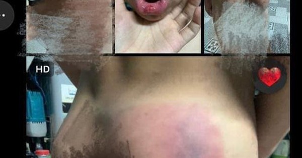 Cô giáo dạy thêm đấm học sinh đau đớn, vụ việc gây xôn xao dư luận