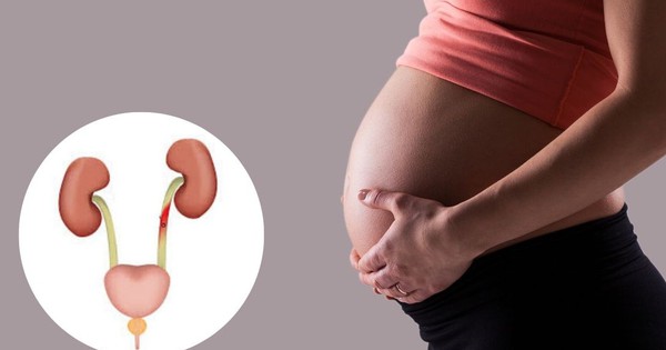 Dấu hiệu viêm đường tiết niệu ở mẹ bầu: Ngừa biến chứng hiệu quả với cách nhận biết đơn giản