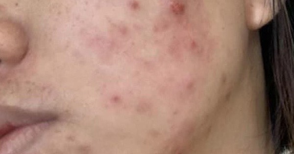 Miền đất hiểm họa: Bí mật độc hại của mỹ phẩm lạ từ mạng