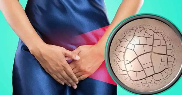 Làm gì để xử lý vấn đề khô âm đạo khi mãn kinh?