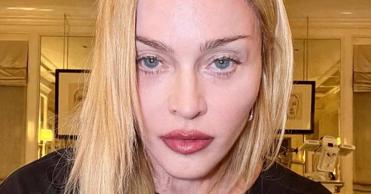 Madonna's Miraculous Recovery: Pop Icon Emerges Stronger Than Ever After ICU Battle