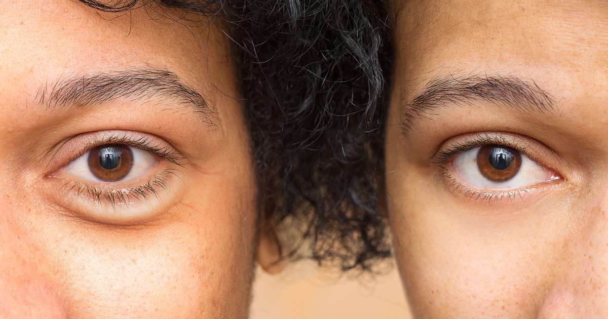 Unlock Bright, Youthful Eyes at an Unbeatable Price: Discover This Rice Water Eye Cream for Under $10!
